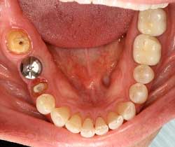 dentista  examenes orales