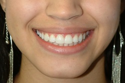 dentista  examenes orales